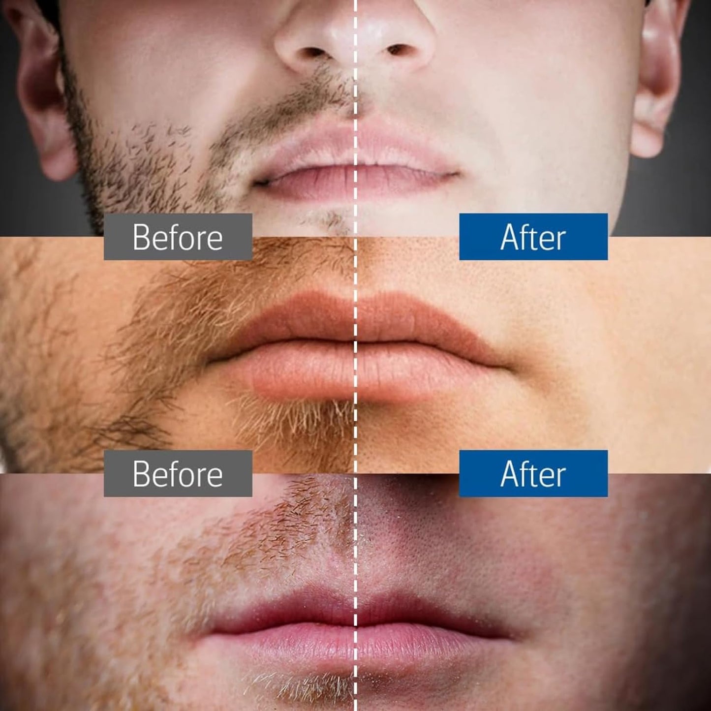 Jodial™ Razor, Safety Razor for Women with 10 Double Edge Safety Razor Blades, Double Edge Razor, Reusable Razor, Plastic Free – Rose Gold